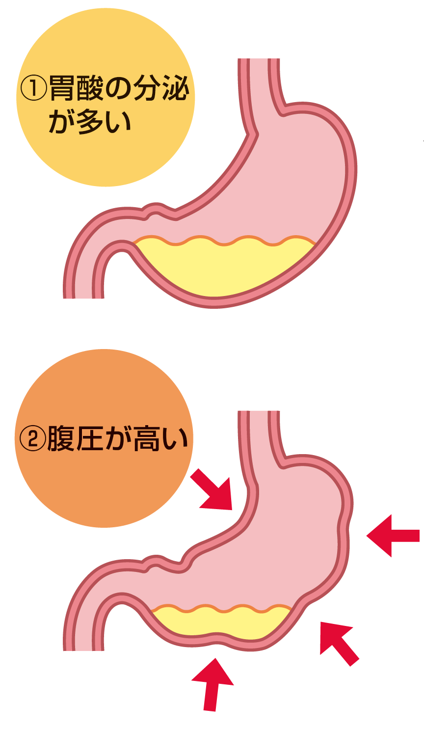 食後 横 に なる