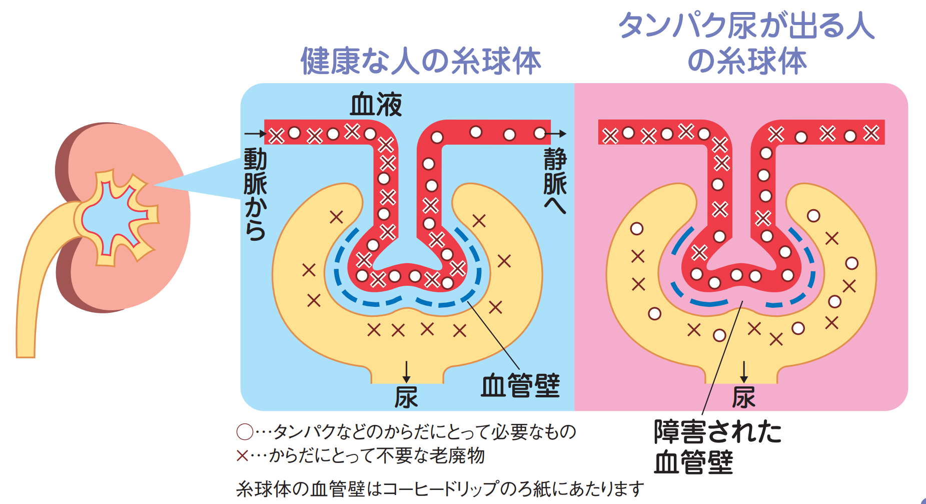 タンパク尿の意味と対策 日本臨床内科医会