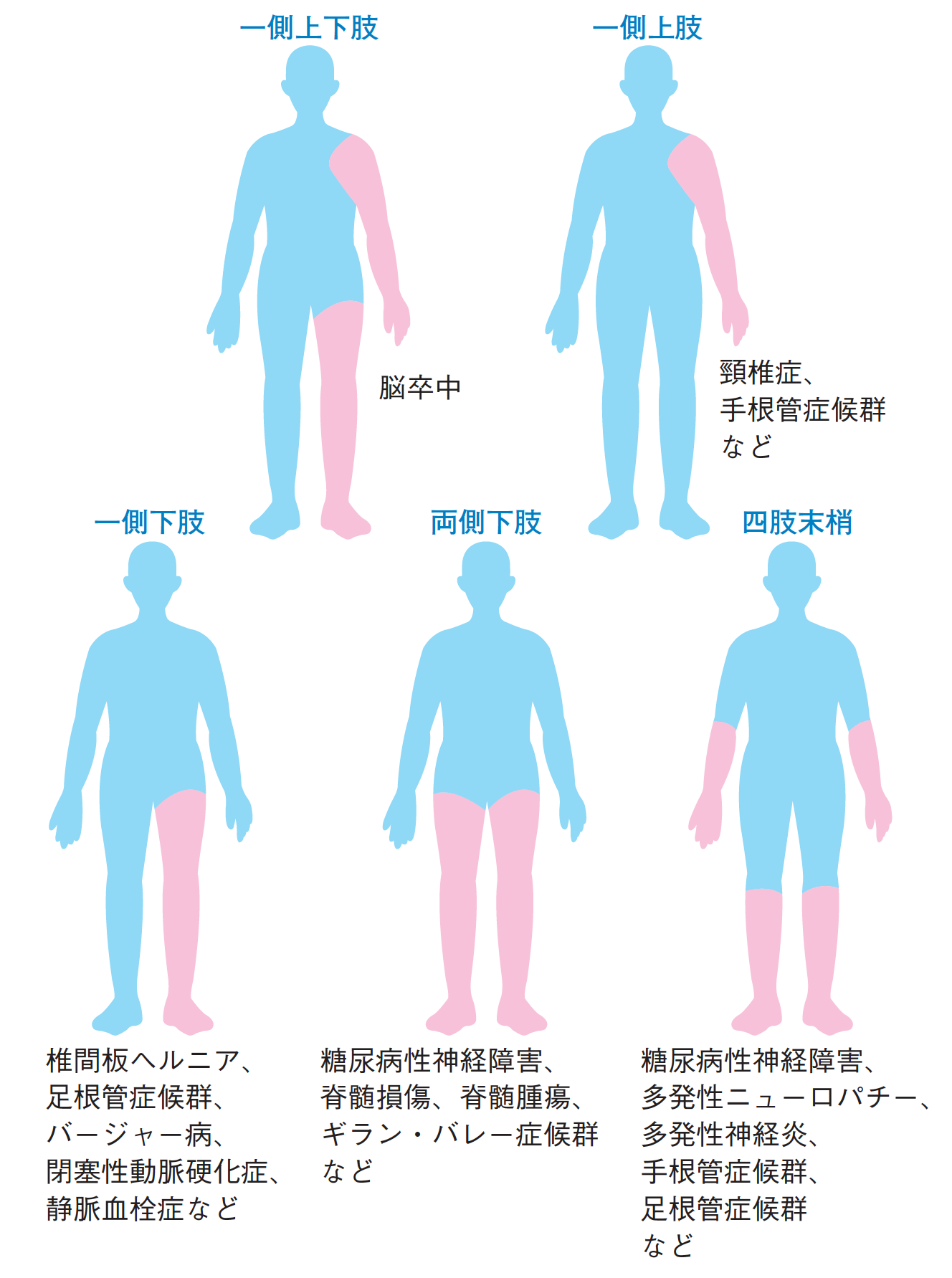 手足のしびれ 痛み 日本臨床内科医会